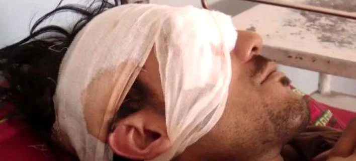 Φρίκη στο Πακιστάν: O πατέρας και οι αδελφοί του του έβγαλαν τα μάτια γιατί ήθελε να παντρευτεί (Εικόνες)